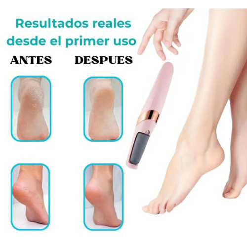 Pedicura Electrica: Pies Suaves en Minutos (Carga USB)