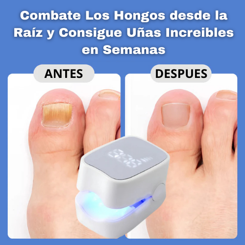 OrthoCare™ – El único tratamiento sin químicos que devuelve el aspecto sano a tus uñas en solo 3 semanas. (+Envío GRATIS)